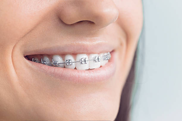 Best Dental Exams and Cleanings  in West Linn, OR